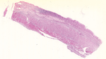 Giunzione gastro-esofagea. Colorazione ematossilina ed eosina
