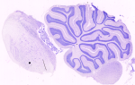 Cervelletto e tronco encefalico. Colorazione di Nissl