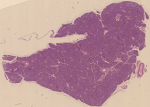 Pancreas. Colorazione: ematossilina ed eosina